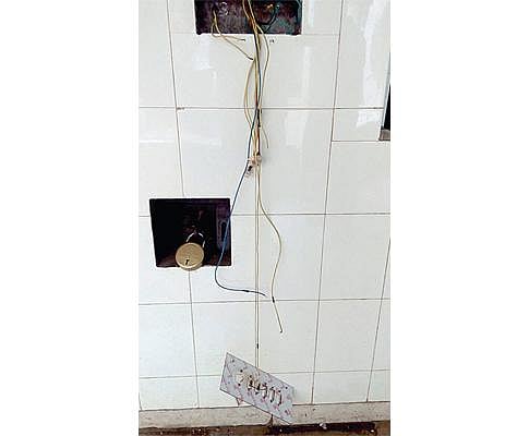 மின் வயரை கடித்தால் என்னாகும்? - தீக்காய சிகிச்சை டாக்டர் தகவல்