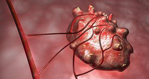 நலம் நலமறிய ஆவல்: கருத்தரிப்புக்கு நீர்க்கட்டிகள் பிரச்சினையில்லை﻿