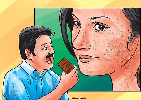 சந்தேகம் சரியா 12: சாக்லேட் சாப்பிட்டால் பருக்கள் அதிகரிக்குமா?﻿