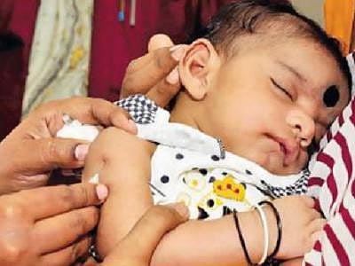 மாணவர்கள் தேர்வை எதிர்கொள்ளும் தருணத்தில் கட்டாய﻿ ரூபெல்லா தட்டம்மை தடுப்பூசி போட ஆயத்தமாகும் சுகாதாரத் துறை: பரிசோதனை அடிப்படையில் மேற்கொள்வதை அரசு தவிர்க்குமா?