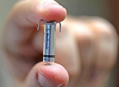 இதயம் காக்கும் பேஸ்மேக்கரில் புதிய தொழில்நுட்பம்!