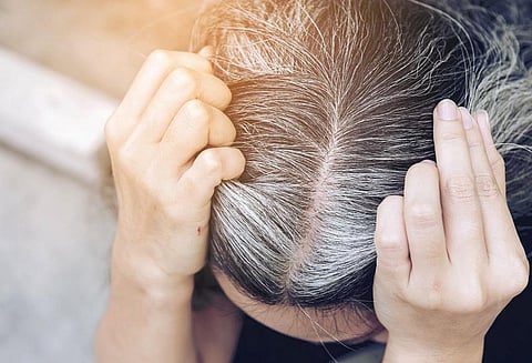 கேளாய் பெண்ணே: வழுக்கை விழ என்ன காரணம்?