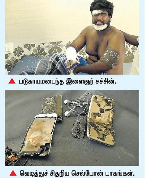 செல்போன் வெடித்து இளைஞர் காயம்﻿