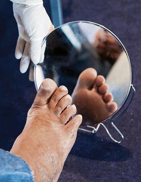 நலம், நலமறிய ஆவல் 31: எரியும் பாதங்கள் ஏன்?