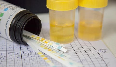 இனிப்பு தேசம் 09: சிறுநீரகத்தை பாதிக்கும் ‘மைக்ரோ’ புரதம்!