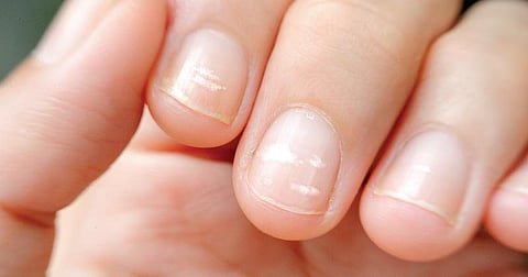 நலம், நலமறிய ஆவல் 48: அறிவு தரும் ‘நாகம்!’