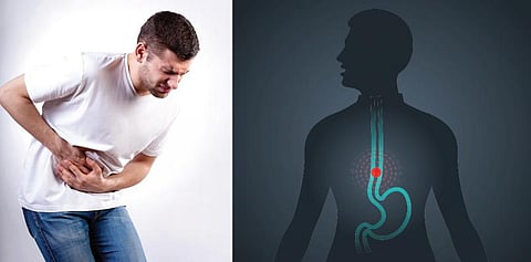 உணவுக்குழாய்ப் புற்றுநோய்... சில உண்மைகள்..!