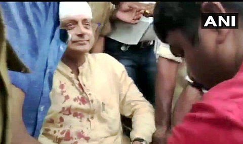 காங்கிரஸ் எம்.பி. சசிதரூர் படுகாயம்: கோயிலில் துலாபாரம் கொடுத்தபோது தராசு சங்கிலி அறுந்து விழுந்தது