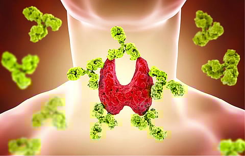 இனி எல்லாம் நலமே 08: தவிர்க்கக்கூடியதா தைராய்டு?