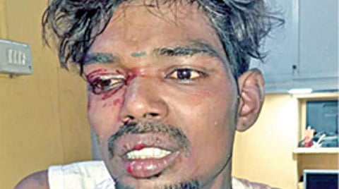 உணவு விநியோக ஊழியரை தாக்கி போன், பணம் பறித்தவர் கைது