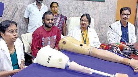 விபத்தில் காலை இழந்த ஹேம்நாத் என்பவருக்கு அதிநவீன செயற்கை கால் பொருத்தப்பட்டது குறித்து விளக்குகிறார் சென்னை அரசு பொது மருத்துவமனை டீன் ஜெயந்தி. கண்காணிப்பாளர் நாராயணசாமி, ஒட்டுறுப்பு அறுவை சிகிச்சை டாக்டர் எஸ்.ஸ்ரீ தேவி. படம்: க.ஸ்ரீபரத்