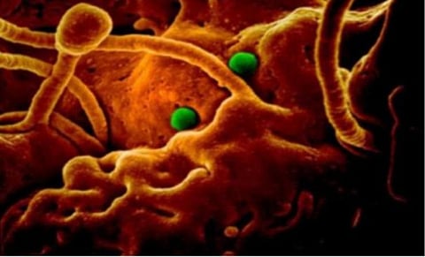 சண்டிகரில் ஒருவருக்கு கரோனா வைரஸ் பாதிப்பு? - தனிமை வார்டில் அனுமதி