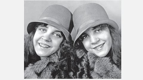 இன்று என்ன நாள்: இடுப்பு ஒட்டி பிறந்த ஹில்டன் சகோதரிகள்