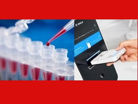 ரேபிட் டெஸ்ட் என்றால் என்ன? கரோனாவைக் கண்டறிய எப்படி உதவும்?