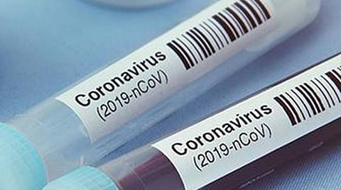 தனியார் ஆய்வகங்களிலும் கரோனா பரிசோதனை இலவசம்: மத்திய அரசு நடவடிக்கை எடுக்க உச்ச நீதிமன்றம் இடைக்கால உத்தரவு