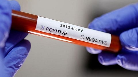 கரோனா நோயாளிகள் ‘டிஸ்சார்ஜ்’ எப்படி நடக்கிறது?- மருத்துவ நிபுணர் விளக்கம்