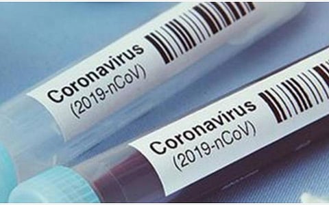 திருப்பூர் மாவட்டத்தில் ஒரே நாளில் 35 பேருக்கு கரோனா தொற்று உறுதி: பாதிக்கப்பட்டவர்களின் எண்ணிக்கை 61 ஆக உயர்வு