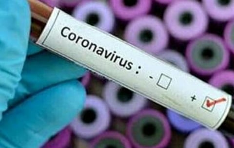 பிரதிநிதித்துவப் படம்