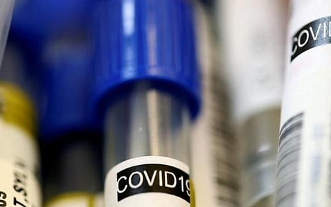 பிரதிநிதித்துவப் படம்.