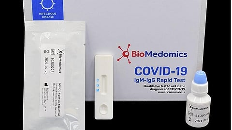 ரேபிட் டெஸ்ட் ‘கிட்’ மூலம் யார் யாருக்கு ‘கரோனா’ பரிசோதனை?