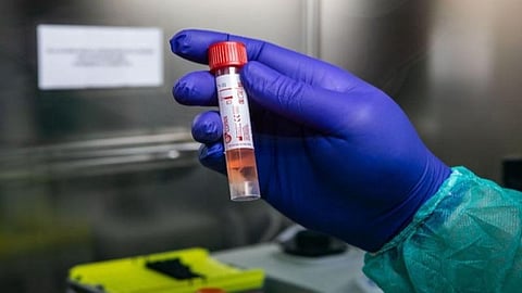 குமரியில் கரோனாவிற்கு சிகிச்சை பெற்ற இருவர் குணமடைந்தனர்: இதுவரை 974 பேருக்கு பரிசோதனை