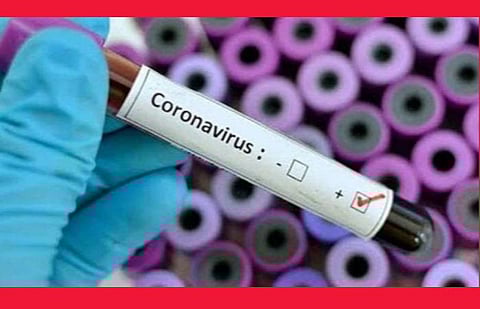 தமிழகத்தில் இன்று 76 பேருக்கு கரோனா: எண்ணிக்கை 1596 ஆனது