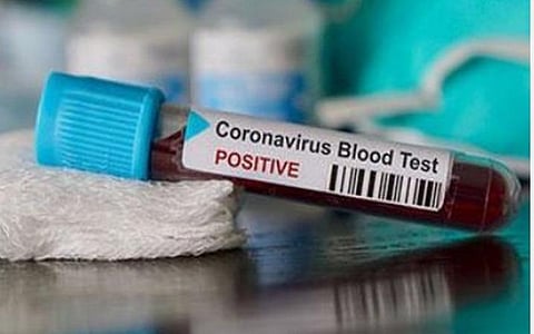 டெல்லியில் காய்கறி வண்டிக் கடைக்காரருக்கு கரோனா வைரஸ் பாதிப்பு; மற்ற கடைக்காரர்களை மிரட்டக் கூடாது: அதிகாரிகள் அறிவுறுத்தல்