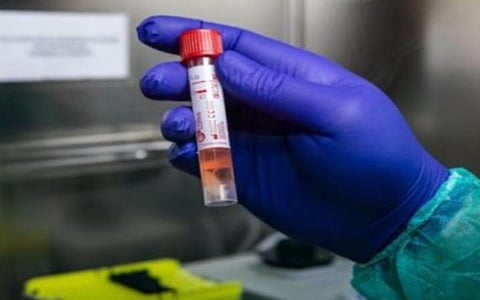 மதுரையில் மேலும் 4 பேருக்கு கரோனா பாதிப்பு