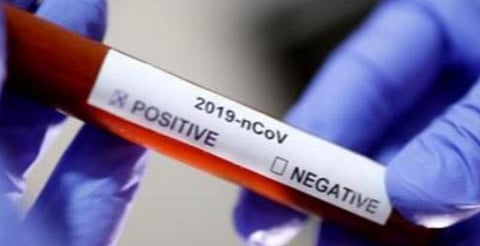 கோவில்பட்டியில் 4 வயதுக் குழந்தைக்கும்  தூய்மைப் பணியாளருக்கும் கரோனா