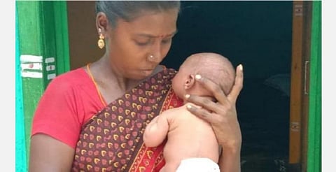 'இந்து தமிழ்' இணையதளச் செய்தி எதிரொலி: சிவகங்கை ஆட்சியர் உதவியால் பச்சிளங் குழந்தையின் முதுகில் இருந்த கட்டி அகற்றம்