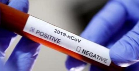 புதுச்சேரியில் மேலும் 5 பேருக்கு கரோனா தொற்று உறுதி  