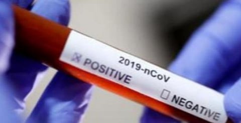 விமானப் பயணி ஒருவருக்கு இன்று தொற்று உறுதி; பச்சை மண்டல வாய்ப்பைப் பறிகொடுத்த கோவை!