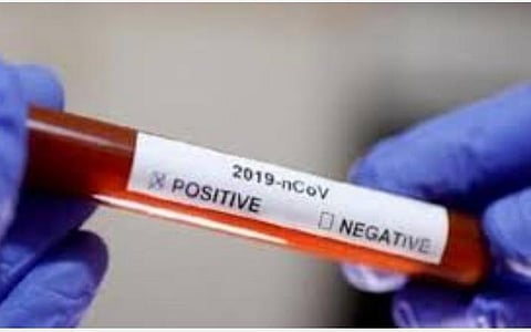 கரோனா பாதிப்பை கண்டறிய இதுவரை 32,42,160 மருத்துவப் பரிசோதனைகள்: மத்திய அரசு தகவல்