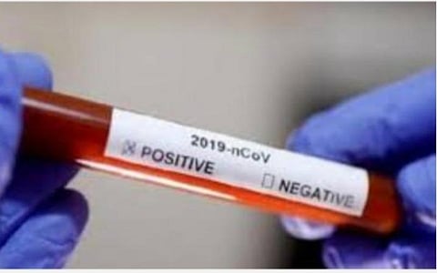 தமிழகத்தில் கரோனா பாதிப்பில் உயிரிழிந்த முதியவர்கள் எத்தனை பேர்?- மத்திய அரசு தகவல்