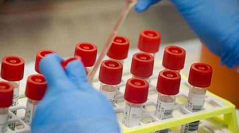 கரோனா பாதிப்பில் இருந்து குணமடைந்த கவுன்சிலர் கைது: ஊர்வலமாக சென்றதால் நடவடிக்கை