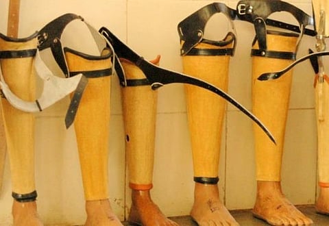 செயற்கை கால்கள்