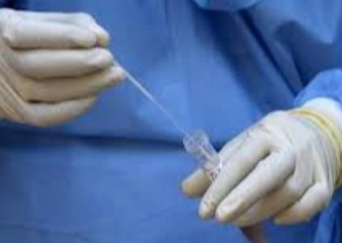 பிரதிநிதித்துவப் படம்