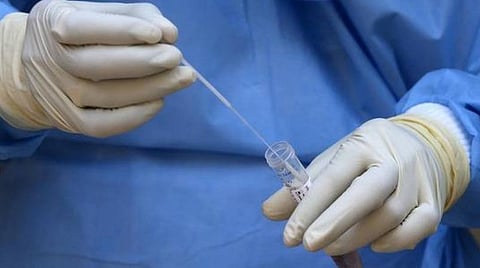 பிரதிநிதித்துவப் படம்