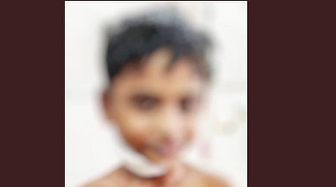 அறுவை சிகிச்சைக்குப் பின்னர் உடல்நலம் தேறி வரும் சிறுவன்