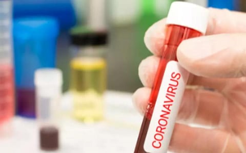 பிரதிநிதித்துவப் படம்