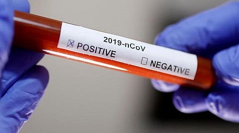 தென்காசி மாவட்டத்தில் கரோனா பாதிப்பு 300-ஐ தாண்டியது: இன்று புதிதாக 18 பேருக்கு தொற்று உறுதி