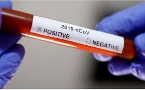 மகாராஷ்டிராவில் ஒரே நாளில் 5000 பேருக்கு கரோனா: மொத்த பாதிப்பு 1.5 லட்சத்தை கடந்தது