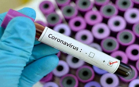 விருதுநகரில் ஒரே நாளில் 58 பேருக்கு கரோனா தொற்று: வேகமாகப் பரவுவதால் மக்கள் அச்சம்