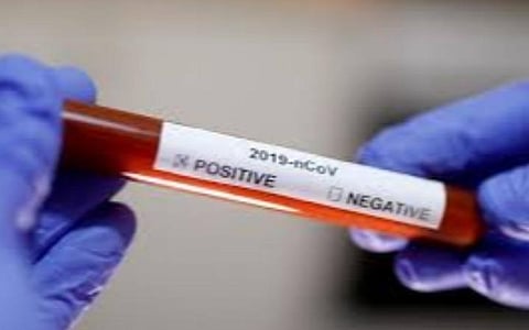 இளம் வயதினரை அதிகம் பாதிக்கும் கரோனா: மதுரையில் 21 வயது முதல் 50 வயதிற்குட்பட்ட 60 சதவீதம் பேர் பாதிப்பு 