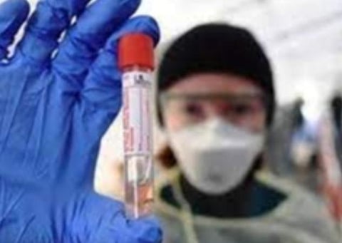 பிரதிநிதித்துவப் படம்