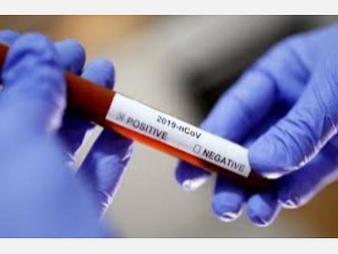 பிரதிநிதித்துவ படம்