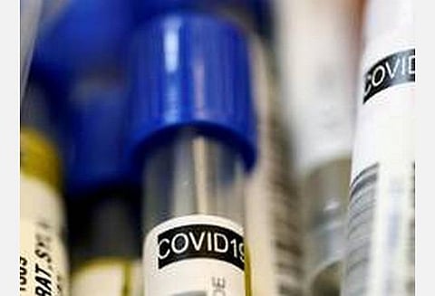 கலிபோர்னியாவில் ஒரே நாளில் 10,201 பேருக்கு கரோனா தொற்று