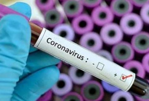 பிரதிநிதித்துவப் படம்