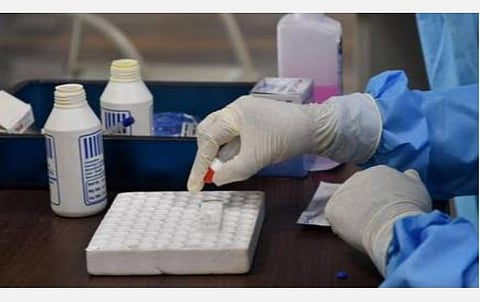 காஞ்சியில் 30 ஆயிரம் பேருக்கு வீடுவீடாக கரோனா பரிசோதனை