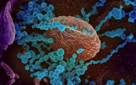 கரோனா அபாயத்தை மதிப்பீடு செய்யும் லைஃபாஸ் கோவிட்: பெங்களூரு ஸ்டார்ட்அப் நிறுவனம் சாதனை